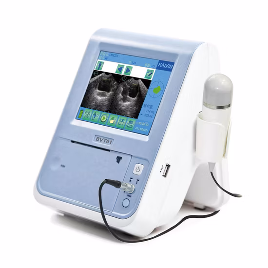Scanner portatile ad ultrasuoni per vescica urinaria di palma Kaixin