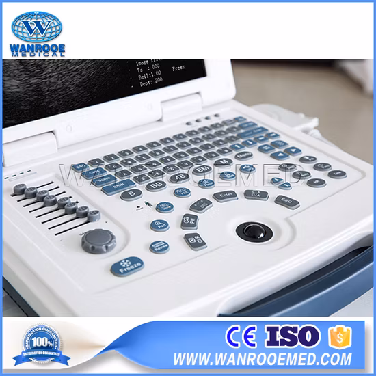 Scanner ad ultrasuoni portatile digitale per apparecchiature di diagnosi ad ultrasuoni